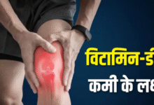 Photo of शरीर में चुपके से घर कर रही है विटामिन डी की कमी? इन 5 संकेतों को पहचानें