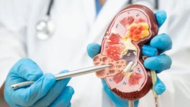 Photo of किडनी डिजीज को साइलेंट किलर क्यों कहा जाता है?