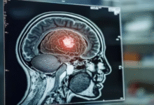 Photo of शरीर की ‘शुगर’ का इस्तेमाल करेक ताकतवर बन रहा ब्रेन ट्यूमर