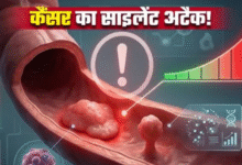 Photo of आंतों में इन दो तरह की गांठ से 5 गुना तक बढ़ जाता है कैंसर का खतरा